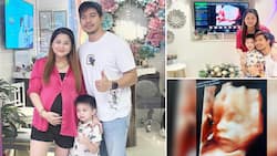 Rodjun Cruz shares sonogram of his, Dianne Medina’s 2nd baby