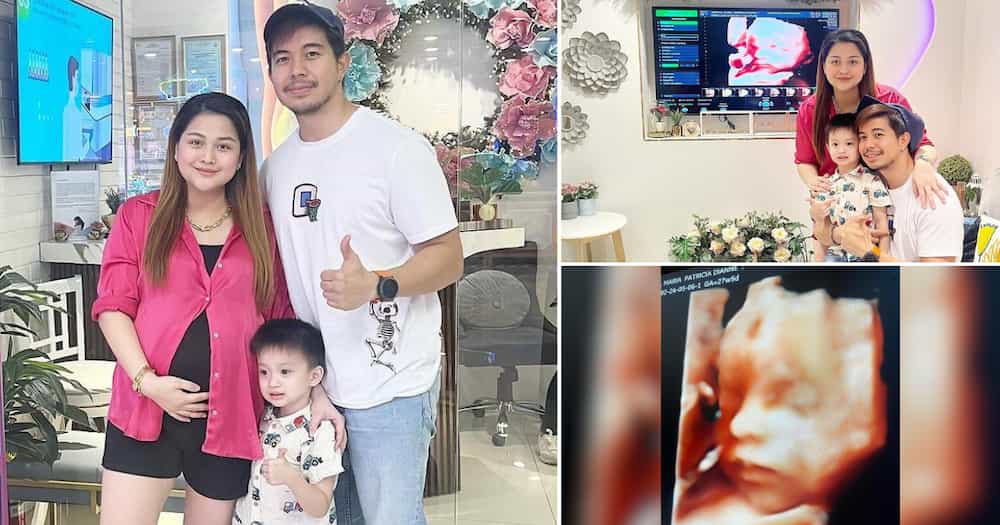 Rodjun Cruz shares sonogram of his, Dianne Medina’s 2nd baby