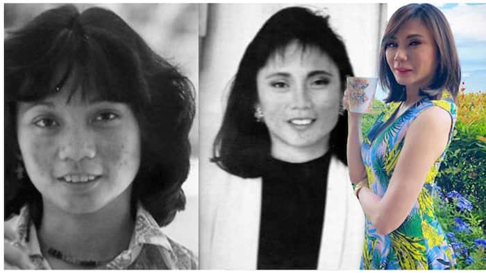Dr. Vicki Belo's stunning transformation wows netizens