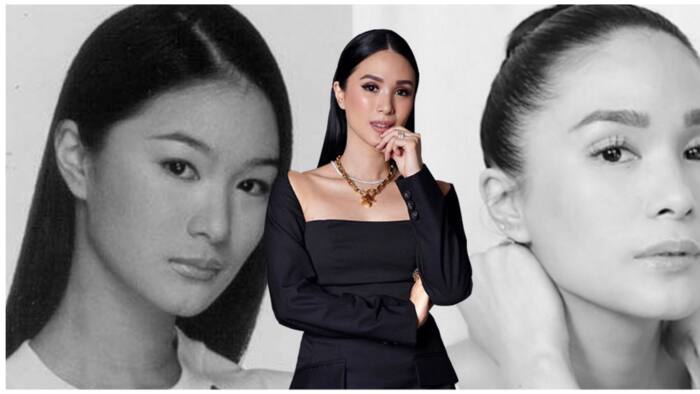 Heart Evangelista, inakusahan ng isang netizen na nagparetoke ng mata