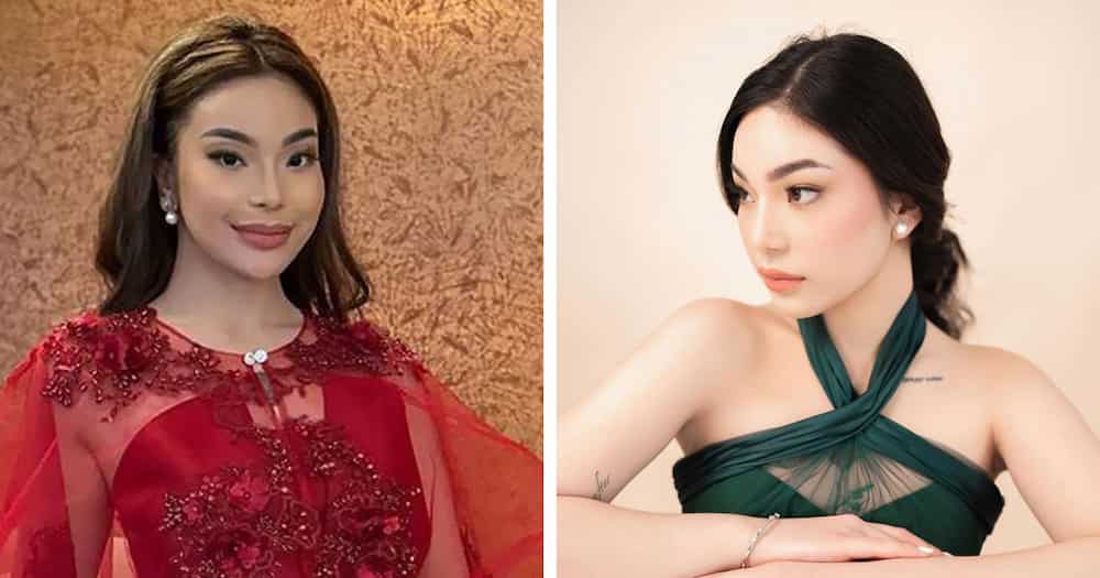 Kitty Duterte reveals getting cosmetic surgery: “Got a rhinoplasty. I've been so happy with my nose”