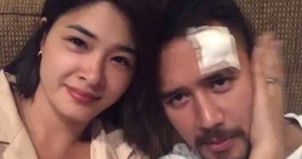 JM De Guzman suffers head injury during taping, "Init Sa Magdamag"