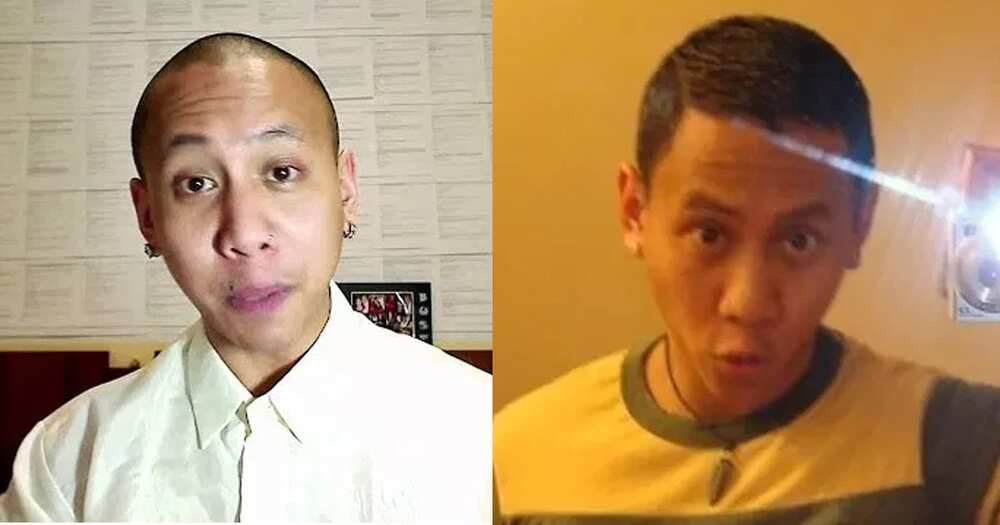 8 Famous bald celebrities when they still had hair 8 Famous bald celebrities when they still had hair