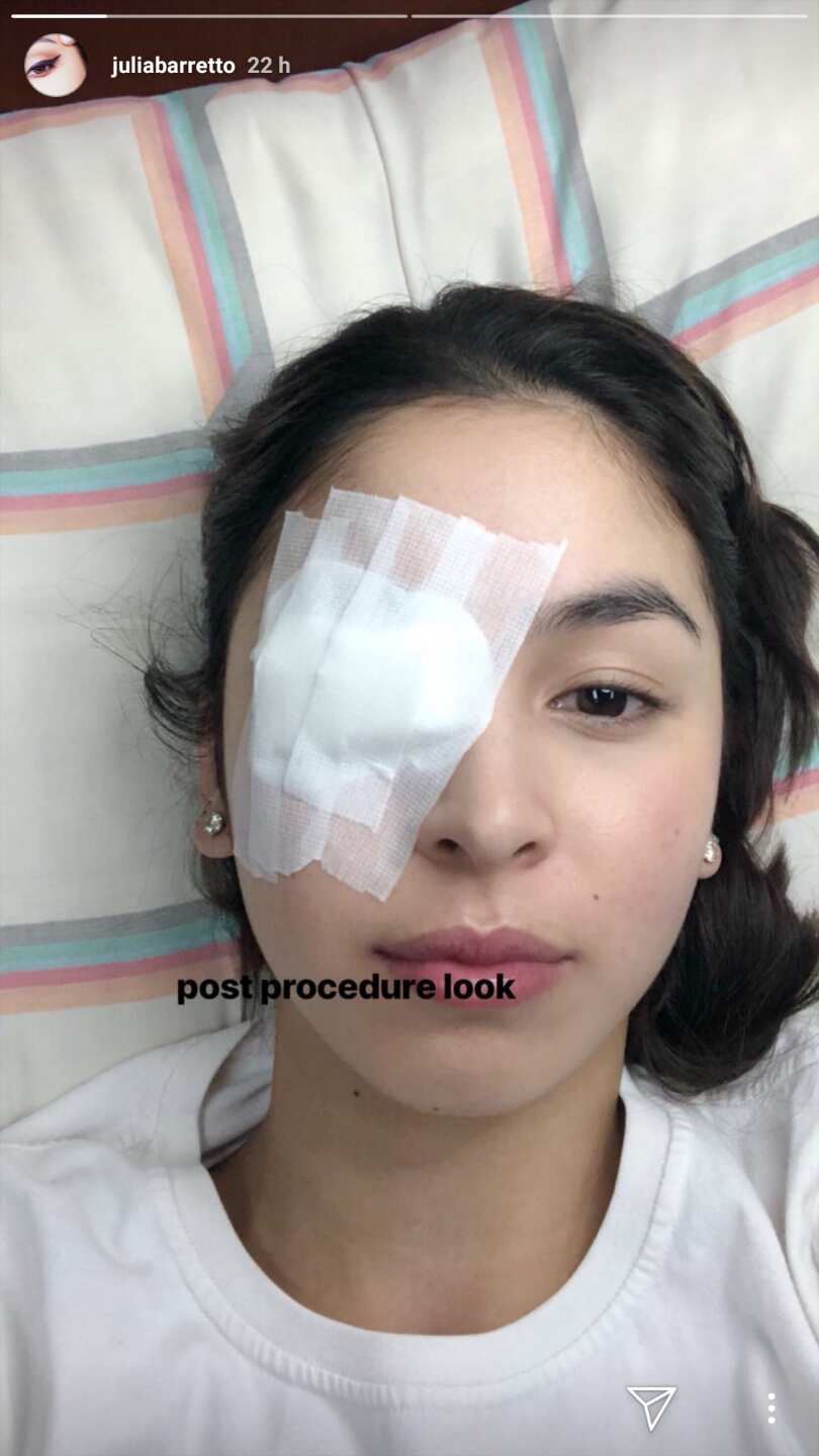 Julia Barretto posts post eye operation photos