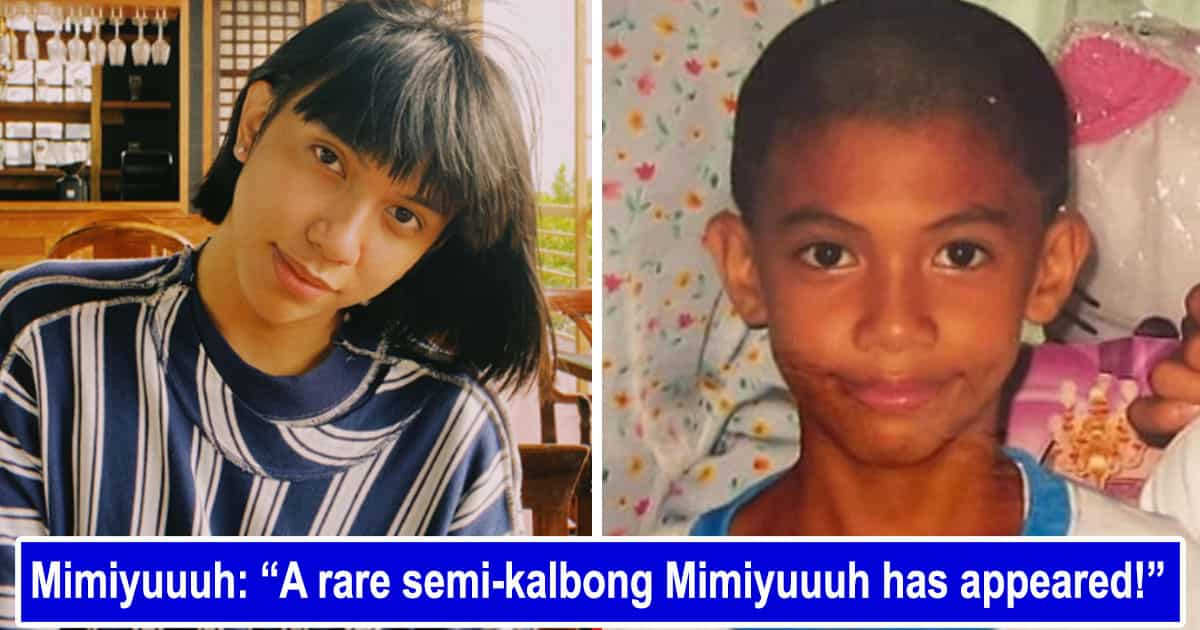 Mimiyuuuh Finlex Semi Kalbo Look Noong Kabataan Pa Niya Kamicomph