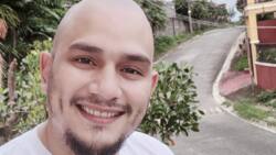Kiko Matos: "Di bale ng walang buhok basta may FB"