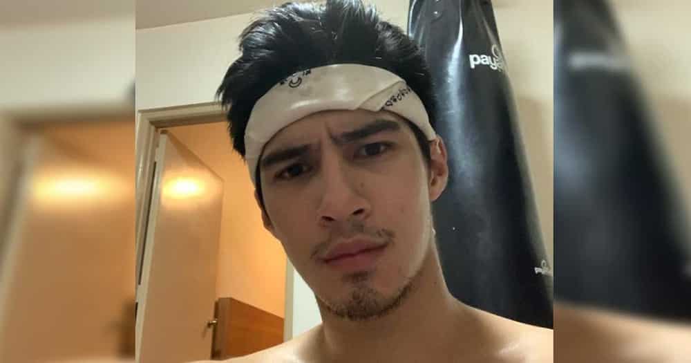 Albie Casiño declares he's not mad at government after viral "congrats to to those who voted in 2016"
