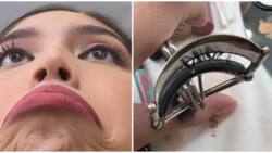Maine Mendoza shares her "eyelash curler nightmare", advises women to be careful when curling their lashes