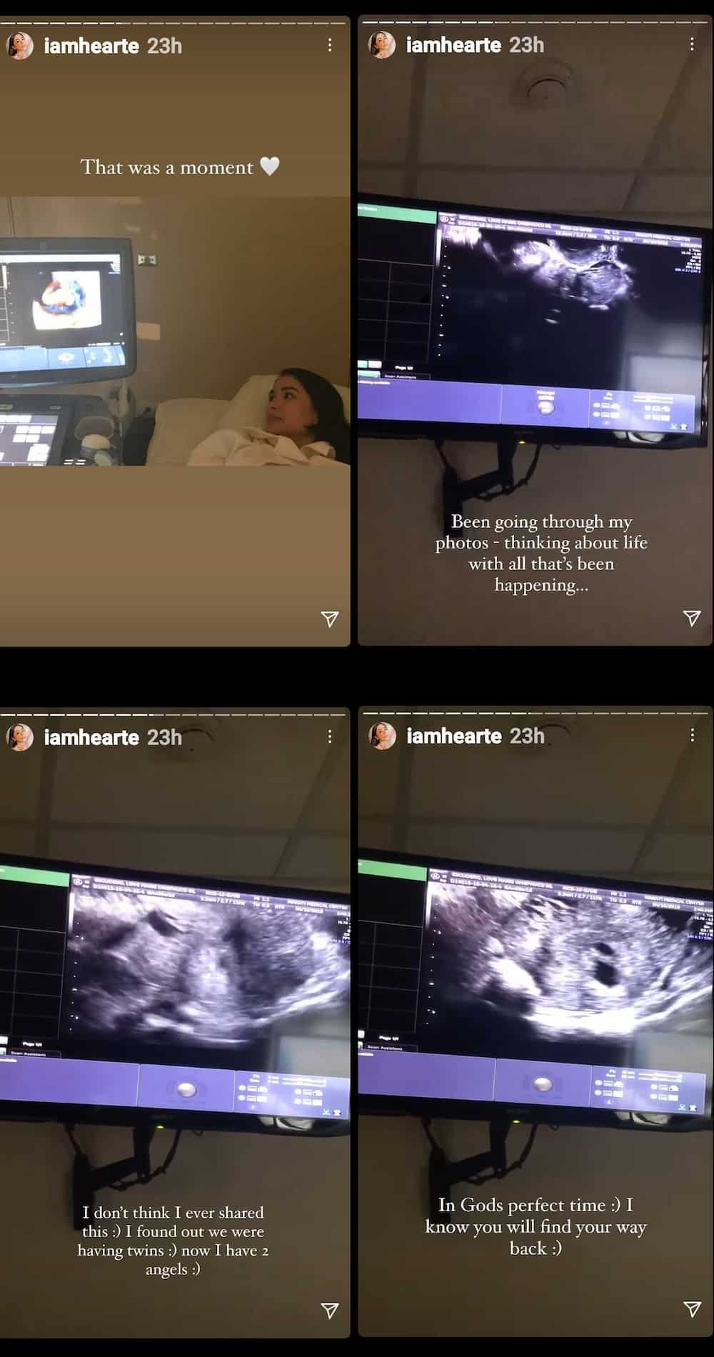 Heart Evangelista recollects pregnancy; shares ultrasound videos of her “2 angels”